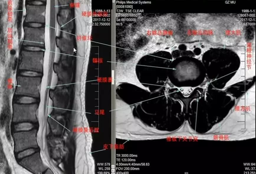 【有声影像园地】常见的脊柱外科疾病